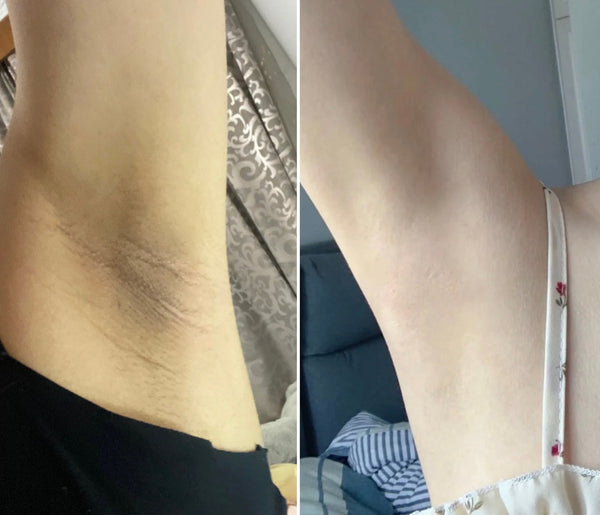 Premium Exfoliating Glove - Smooth, Radiant Skin with Every Use