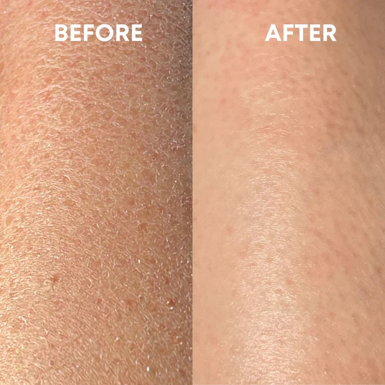 Premium Exfoliating Glove - Smooth, Radiant Skin with Every Use