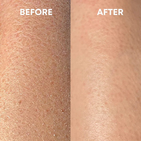 Premium Exfoliating Glove - Smooth, Radiant Skin with Every Use