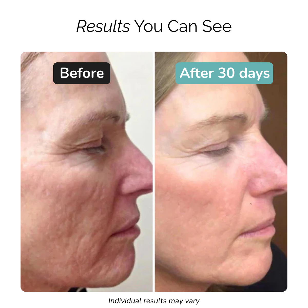 Naturala™ Ageless Radiance Wand