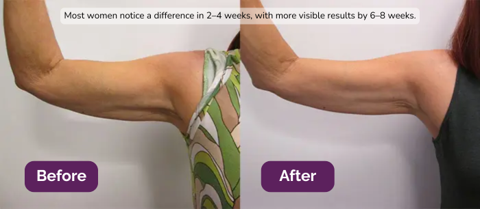 Naturala™ Body Contour Pro Wand