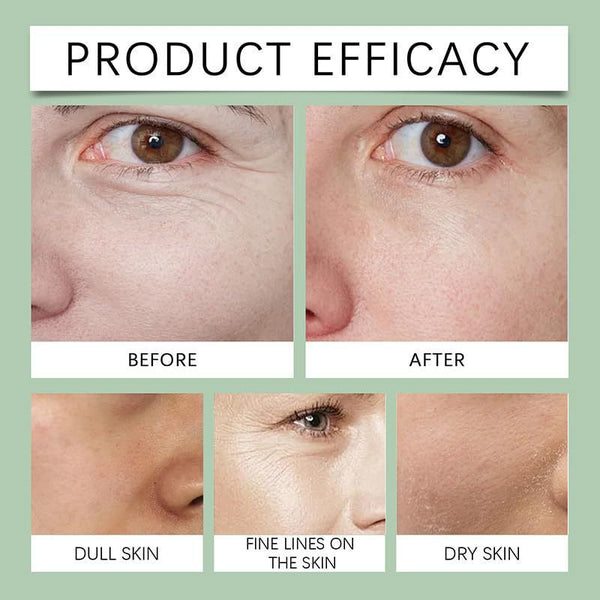 Noni Glow Serum – Hydrate & Refresh