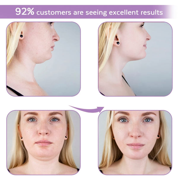 Naturala™ Ageless V Contour Firming Mask (skin-safe)